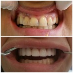 Dr Kristian Gerga - radovi - pre i posle