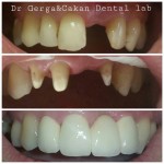 Dr Kristian Gerga - radovi - pre i posle